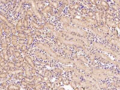 Immunohistochemistry-Paraffin: HuR/ELAVL1 Antibody [NBP2-98790] - Immunochemical staining HuR/ELAVL1 in human kidney with rabbit polyclonal antibody at 1:300 dilution, formalin-fixed paraffin embedded sections.