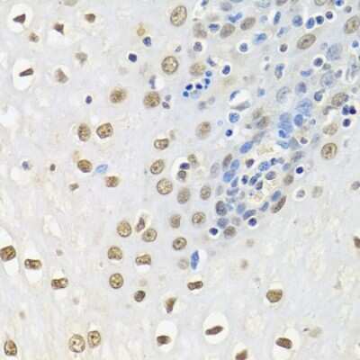 Immunohistochemistry-Paraffin: HuR/ELAVL1 Antibody [NBP3-02947] - Paraffin-embedded human esophagus using HuR/ELAVL1 antibody at dilution of 1:100 (40x lens).