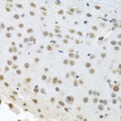 Immunohistochemistry-Paraffin: HuR/ELAVL1 Antibody [NBP3-02947] - Paraffin-embedded mouse brain using HuR/ELAVL1 antibody at dilution of 1:100 (40x lens).