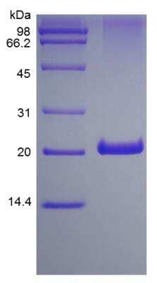 SDS-Page: Human 4-1BB/TNFRSF9/CD137 Protein [NBP2-34958]