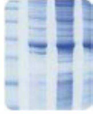 SDS-Page: Human Bladder Whole Tissue Lysate (Whole Normal) [NB820-59173] - Protein lysate is verified on SDS-PAGE analysis as a consistent pattern. 