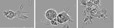 B Cell Stimulation: Human Blood B Booster Kit [DDXK-HuBBB] - Microscopic observation during the time course of the culture.