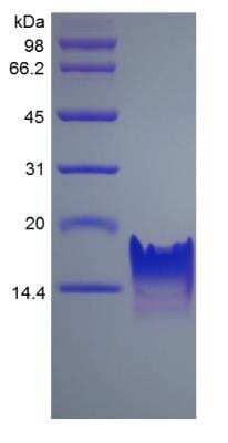 SDS-Page: Human CXCL11/I-TAC Protein [NBP2-34922]