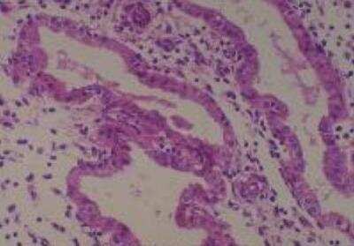 Human Multi Tissue MicroArray (Normal Adjacent) (NBP2-30217): Novus ...