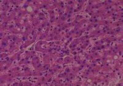 Human Multi Tissue MicroArray (Normal Adjacent) (NBP2-30217): Novus ...