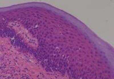Human Multi Tissue MicroArray (Normal Adjacent) (NBP2-30217): Novus ...