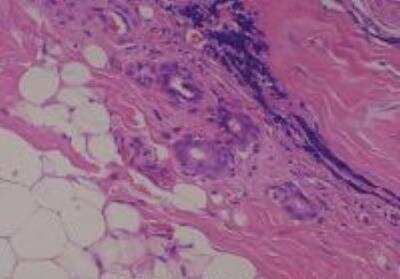 Human Multi Tissue MicroArray (Normal Adjacent) (NBP2-30217): Novus ...