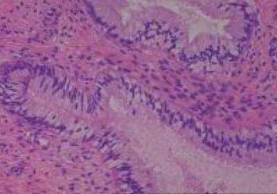 Human Multi Tissue MicroArray (Normal Adjacent) (NBP2-30217): Novus ...