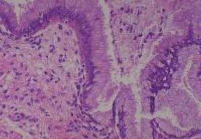 Human Multi Tissue MicroArray (Normal Adjacent) (NBP2-30217): Novus ...