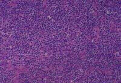 Human Multi Tissue MicroArray (Normal Adjacent) (NBP2-30217): Novus ...