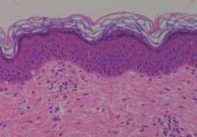 Human Multi Tissue MicroArray (Normal Adjacent) (NBP2-30217): Novus ...