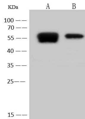 Western Blot Human Coronavirus Nucleocapsid Protein Antibody - Azide and BSA Free