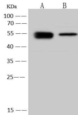 Western Blot: Human Coronavirus Nucleocapsid Protein Antibody [NBP3-12769] - Sample Human coronavirus (HCoV-OC43) Nucleoprotein / NP ProteinLane A: 5ngLane B: 1ngSecondaryGoat Anti-Rabbit IgG (H+L)/HRP at 1/10000 dilutionDeveloped using the ECL technique.Performed under reducing conditions.