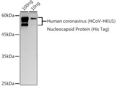 Western Blot Human Coronavirus Nucleocapsid Protein Antibody - Azide and BSA Free