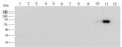 Western Blot: Human Coronavirus Spike Protein Antibody (05) [NBP3-14664] - Sample: Reocombinant Protein 10 ngLane 1: SARS-CoV-2 Spike S1-His Lane 2: SARS-CoV-2 Spike S1 NTD-Fc & AVI Lane 3: SARS-CoV-2 Spike S1 NTD-His & AVI Lane 4: SARS-CoV-2 Spike RBD-His Lane 5: SARS-CoV-2 Spike S2 ECD-His Lane 6: SARS-CoV-2 Spike S1+S2 ECD-His Lane 7: SARS-CoV Spike S1+S2 ECD-His Lane 8: MERS-CoV Spike S1+S2 ECD-His Lane 9: HCoV-NL63 Spike S1+S2 ECD-His Lane 10: HCoV-229E Spike S1+S2 ECD-His Lane 11: HCoV-HKU1 (isolate N5) Spike S1+S2 ECD-His Lane 12: HCoV-OC43 Spike S1+S2 ECD-His