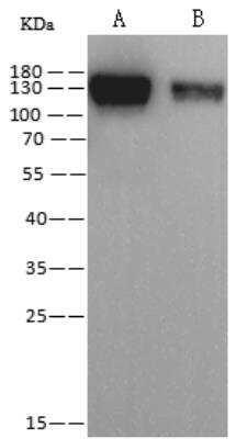 Western Blot: Human Coronavirus Spike Protein Antibody (07) [NBP3-06647] - Human coronavirus HKU1 (isolate N1) (HCoV-HKU1) Spike/S1 Protein. Lane A: 100ng, Lane B: 20ng. SecondaryGoat Anti-Mouse IgG (H+L)/HRP at 1/10000 dilutionDeveloped using the ECL technique.Performed under reducing conditions.