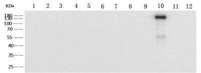 Western Blot: Human Coronavirus Spike Protein Antibody (11) [NBP3-14653] - Anti- Human Coronavirus Spike Protein mouse monoclonal antibody at 1:1000 dilution.Sample: Reocombinant Protein 10 ngLane 1: SARS-CoV-2 Spike S1-HisLane 2: SARS-CoV-2 Spike S1 NTD-Fc & AVILane 3: SARS-CoV-2 Spike S1 NTD-His & AVILane 4: SARS-CoV-2 Spike RBD-HisLane 5: SARS-CoV-2 Spike S2 ECD-HisLane 6: SARS-CoV-2 Spike S1+S2 ECD-HisLane 7: SARS-CoV Spike S1+S2 ECD-HisLane 8: MERS-CoV Spike S1+S2 ECD-HisLane 9: HCoV-NL63 Spike S1+S2 ECD-HisLane 10: HCoV-229E Spike S1+S2 ECD-HisLane 11: HCoV-HKU1 (isolate N5) Spike S1+S2 ECD-HisLane 12: HCoV-OC43 Spike S1+S2 ECD-HisSecondaryGoat Anti-Mouse IgG (H+L)/HRP at 1/10000 dilutionDeveloped using the ECL technique.Performed under reducing conditions.