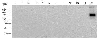 Western Blot: Human Coronavirus Spike Protein Antibody (29) [NBP3-14658] - Anti-HCoV-OC43 mouse monoclonal antibody at 1:1000 dilution.Sample: Reocombinant Protein 10 ngLane 1: SARS-CoV-2 Spike S1-His Lane 2: SARS-CoV-2 Spike S1 NTD-Fc & AVILane 3: SARS-CoV-2 Spike S1 NTD-His & AVILane 4: SARS-CoV-2 Spike RBD-HisLane 5: SARS-CoV-2 Spike S2 ECD-HisLane 6: SARS-CoV-2 Spike S1+S2 ECD-HisLane 7: SARS-CoV Spike S1+S2 ECD-HisLane 8: MERS-CoV Spike S1+S2 ECD-HisLane 9: HCoV-NL63 Spike S1+S2 ECD-HisLane 10: HCoV-229E Spike S1+S2 ECD-HisLane 11: HCoV-HKU1 (isolate N5) Spike S1+S2 ECD-HisLane 12: HCoV-OC43 Spike S1+S2 ECD-HisSecondaryGoat Anti-Mouse IgG (H+L)/HRP at 1/10000 dilutionDeveloped using the ECL technique.Performed under reducing conditions.