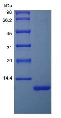 SDS-Page: Recombinant Human IGF-I/IGF-1 Protein [NBP2-34947]