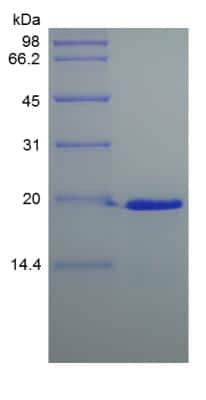 SDS-Page: Human Desert Hedgehog C23II Protein [NBP2-34949]