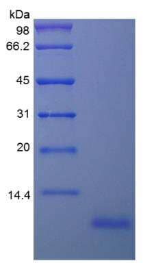 SDS-Page: Human EPGN Protein [NBP2-34987]