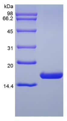 SDS-Page: Human Flt-3 Ligand Protein [NBP2-34868]