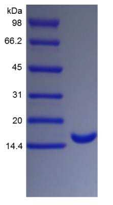 SDS-Page: Human G-CSF Protein [NBP2-34884]