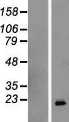 Western Blot: Growth Hormone Overexpression Lysate (Native) [NBL1-11063] - Left-Empty vector transfected control cell lysate (HEK293 cell lysate); Right -Over-expression Lysate for Human Growth Hormone.