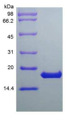 SDS-Page: Human IFN-omega/IFNW1 Protein [NBP2-35893]