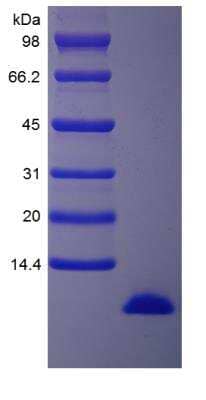 SDS-Page: Human IGF-I 15N Protein [NBP2-35896]