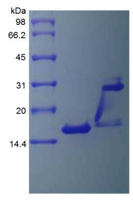 SDS-Page: Human IL-17/IL-17A Protein [NBP2-35040]