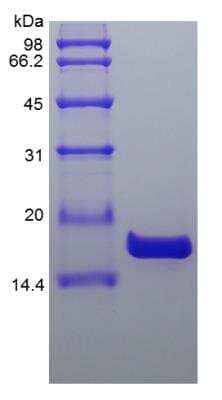 SDS-Page: Human IL-36 beta/IL-1F8 153 a.a Protein [NBP2-34882]