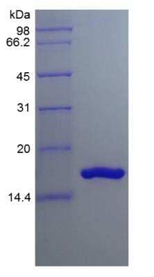 SDS-Page: Human IL-36 beta/IL-1F8 157 a.a Protein [NBP2-34887]