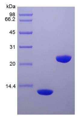 SDS-Page: Human IL-5 Protein [NBP2-34897]