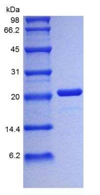 SDS-Page: Human IL-6 Protein [NBP2-34901]