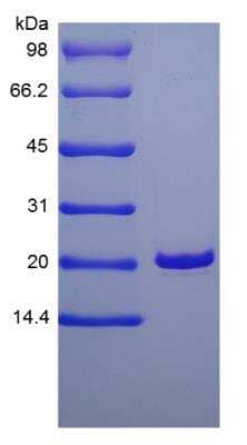 SDS-Page: Human KGF/FGF-7 Protein [NBP2-34924]