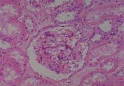 Hematoxylin & Eosin Stain: Human Kidney Tissue MicroArray (Cancer) [NBP2-30220] -  51. Kidney normal of #4