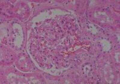 Hematoxylin & Eosin Stain: Human Kidney Tissue MicroArray (Cancer) [NBP2-30220] - 54. Kidney normal of No. 21