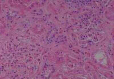 Hematoxylin & Eosin Stain: Human Kidney Tissue MicroArray (Cancer) [NBP2-30220] - 55. Kidney normal of No. 30