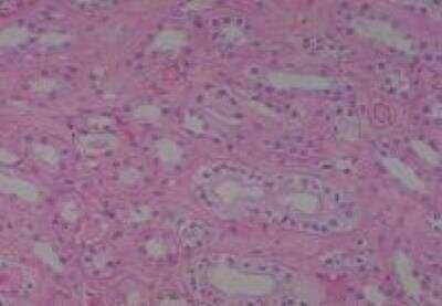 Hematoxylin & Eosin Stain: Human Kidney Tissue MicroArray (Cancer) [NBP2-30220] - 56. Kidney normal of No. 36