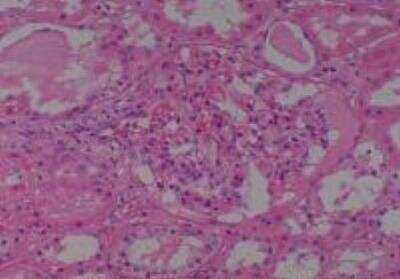 Hematoxylin & Eosin Stain: Human Kidney Tissue MicroArray (Cancer) [NBP2-30220] - 57. Kidney normal of No. 42