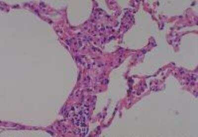 Hematoxylin & Eosin Stain: Human Lung Tissue MicroArray (Cancer metastasis) [NBP2-30222] -  55. Lung normal lung (adjacent to cancer, match of #32)