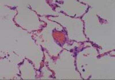 Hematoxylin & Eosin Stain: Human Lung Tissue MicroArray (Cancer metastasis) [NBP2-30222] - 57.Lung normal lung (apart from cancer, match of #14)