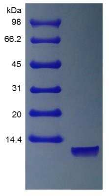 SDS-PAGE Recombinant Human Neuregulin-1 alpha/NRG1 alpha Protein