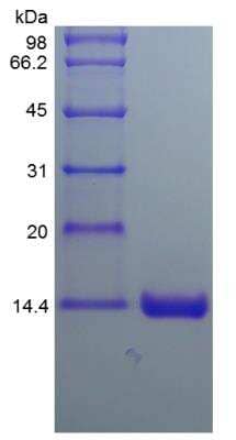 SDS-Page: Human Otoraplin/OTOR Protein [NBP2-35197]