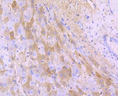 Immunohistochemistry-Paraffin: Human Serum Albumin Antibody (JF32-10) [NBP2-66894] - Analysis of paraffin-embedded human liver tissue using anti-Albumin antibody. Counter stained with hematoxylin.