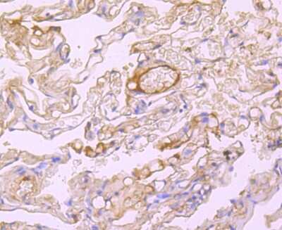 Immunohistochemistry-Paraffin: Human Serum Albumin Antibody (JF32-10) [NBP2-66894] - Analysis of paraffin-embedded human lung tissue using anti-Albumin antibody. Counter stained with hematoxylin.