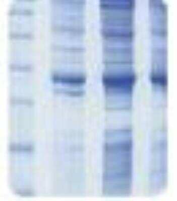 SDS-Page: Human Skin Whole Tissue Lysate (Adult Whole Normal) [NB820-59254] - man Skin Whole Tissue Lysate (Whole Normal) [NB820-59254] - Protein lysate is verified on SDS-PAGE analysis as a consistent pattern.