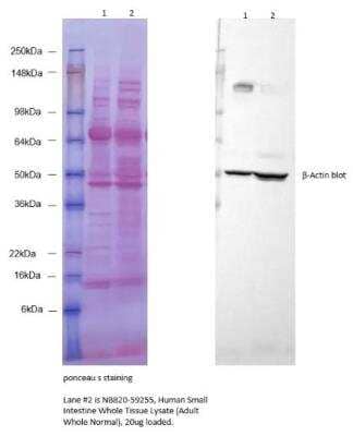 Western Blot: Human Small Intestine Whole Tissue Lysate (Adult Whole Normal) [NB820-59255] - Western blot analysis using Human Small Intestine Whole Tissue Lysate. Image from verified customer review.