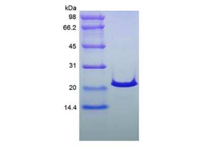 SDS-Page: Human Sonic Hedgehog/Shh Protein [NBP2-35265]